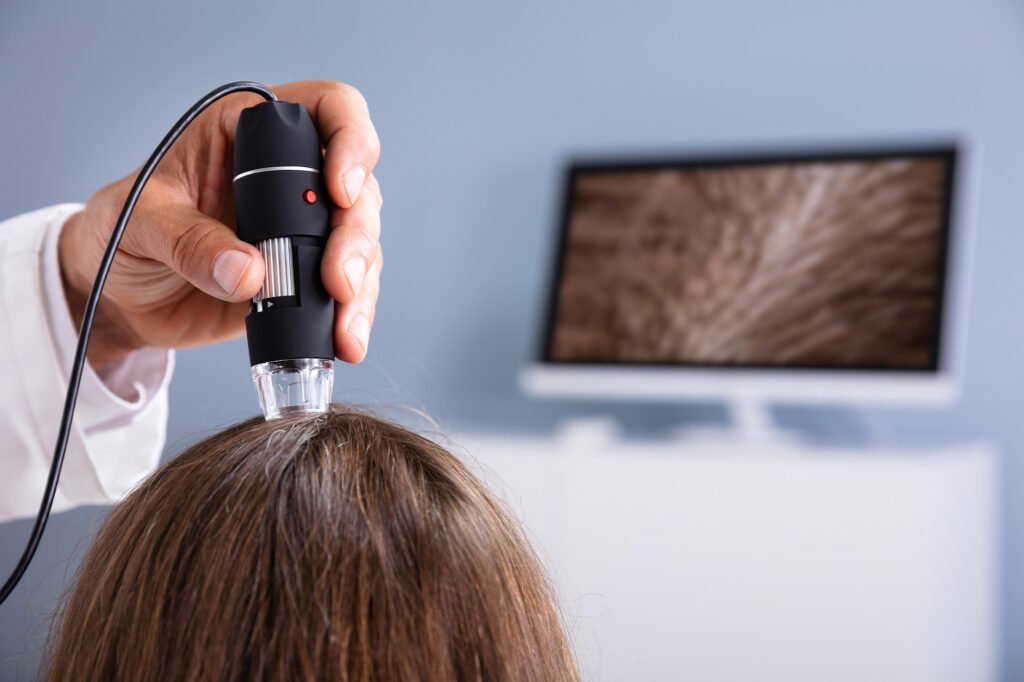 Ultrassom do couro cabeludo na investigação da queda de cabelo